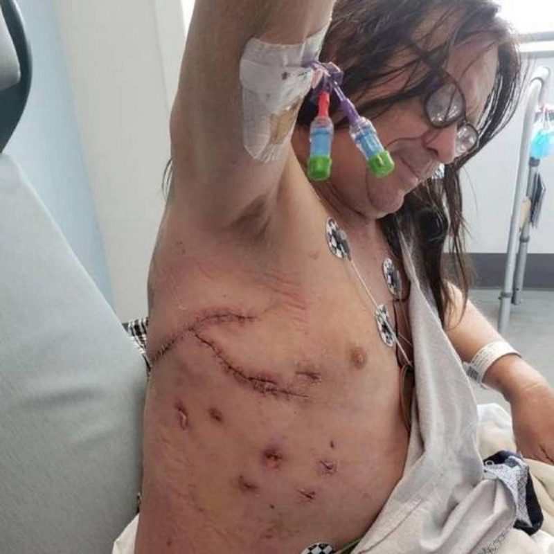 Nelson perdeu parte do pulm&atilde;o e teve o f&iacute;gado perfurado – Foto: Reprodu&ccedil;&atilde;o/ Murrugun The mystic/Facebook