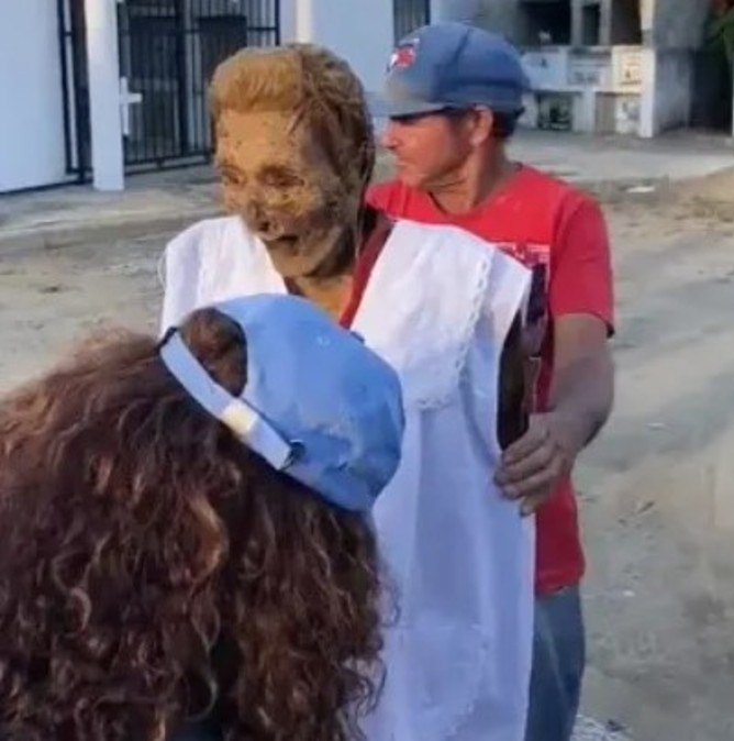 Os ossos ainda se mantinham firmes o bastante para o corpo conseguir ficar de p&eacute; com pouqu&iacute;ssimo apoio. – Foto: NY Post/Divulga&ccedil;&atilde;o/ND