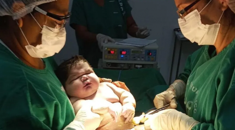 Beb&ecirc; ‘gigante’ nasce pesando 7kg e surpreende m&atilde;e: ‘n&atilde;o esperava essa surpresa’ – Foto: Divulga&ccedil;&atilde;o/SES-AM/Reprodu&ccedil;&atilde;o/ND