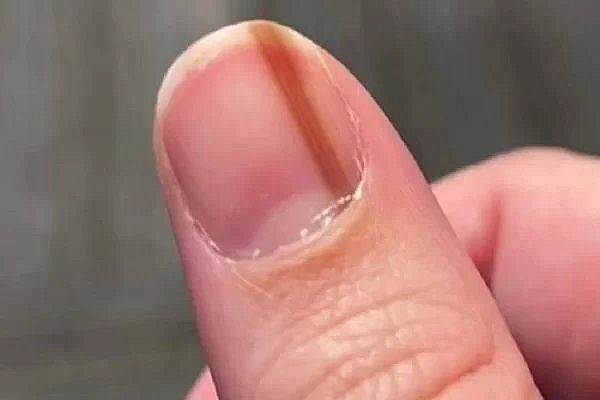 Jovem &eacute; espancada em um bar por causa de uma unha posti&ccedil;a – Foto: Internet/Reprodu&ccedil;&atilde;o/ND