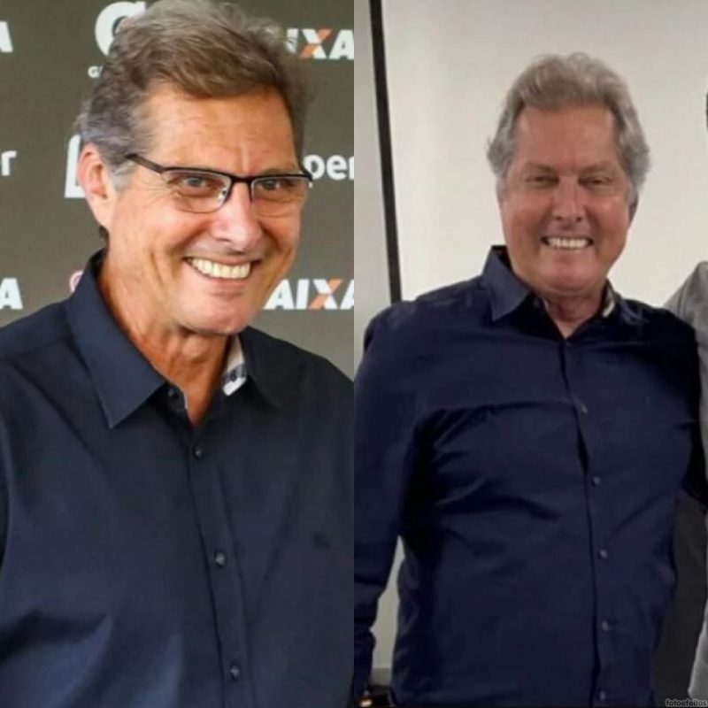 Oswaldo de Oliveira viralizou depois de passar por um procedimento estético duvidoso