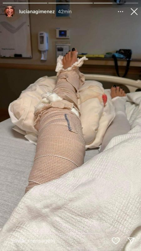 Luciana Gimenez mostra perna destruída após acidente em Aspen &#8211; Foto: Divulgacão/Observatório dos Famosos/ND