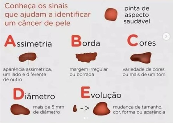 Regras do ABCDE – Foto: Divulga&ccedil;&atilde;o