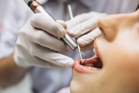 Mulher ser&aacute; indenizada ap&oacute;s extra&ccedil;&atilde;o de dente mal feita em Balne&aacute;rio Cambori&uacute; – Foto: Freepik