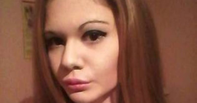 Mulher quer ter as maiores ma&ccedil;&atilde;s do rosto do mundo – Foto: Reprodu&ccedil;&atilde;o/Instagram/@andrea88476/ND