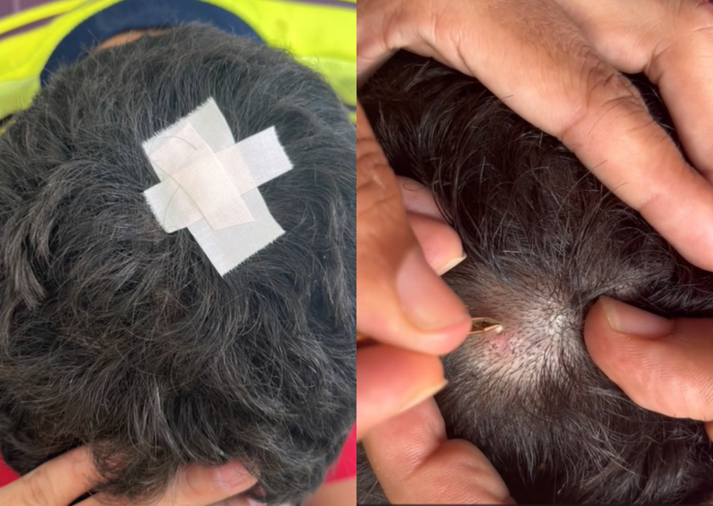 Mother removes animal from son's head and video goes viral — Photo: @renataagoulartt/TikTok/Reproduction/ND