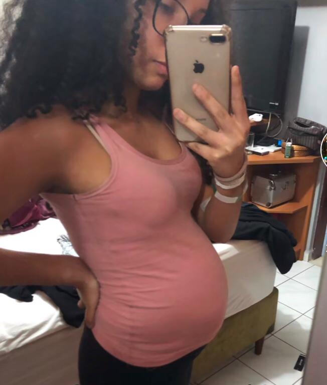 Mariana descobriu o cisto em julho de 2020, no in&iacute;cio da pandemia de Covid-19. – Foto: mari.aoss/Tiktok/Divulga&ccedil;&atilde;o/ND