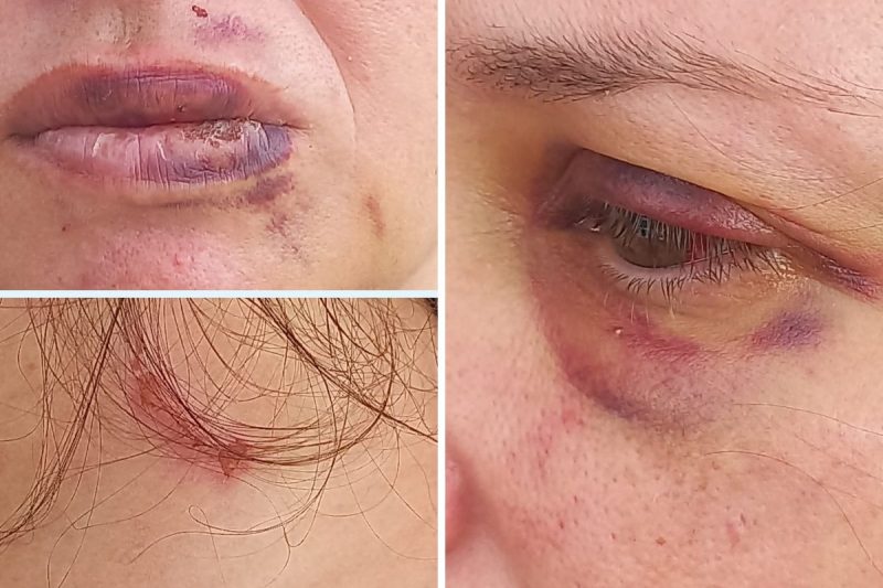 Eliana* vai realizar o exame de corpo delito nesta quarta-feira (22) – Foto: Marcelo Tomazelli/ND