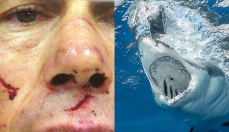 Mergulhador é atacado por tubarão