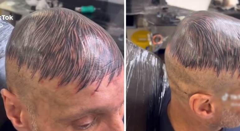 Homem calvo faz tatuagem no lugar do cabelo e viraliza na web: 'Lindo  demais