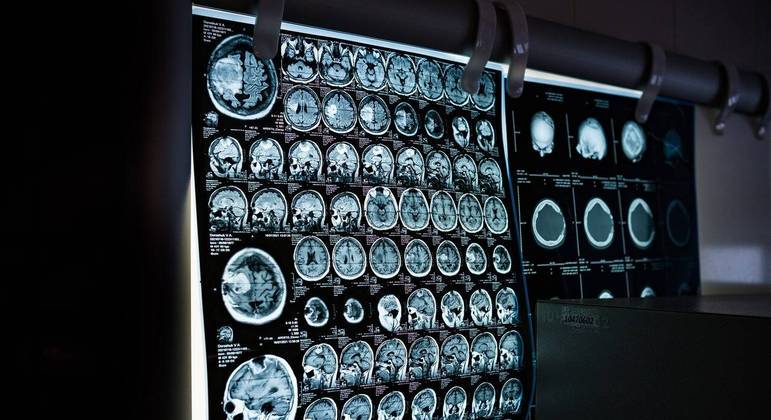 &Eacute; um tumor que foi recentemente inclu&iacute;do pela OMS – Foto: Pixabay/Divulga&ccedil;&atilde;o/ND