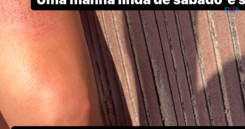 Graciela Machado estava filmando os cachorros quando caiu no buraco – Foto: Reprodu&ccedil;&atilde;o/Internet