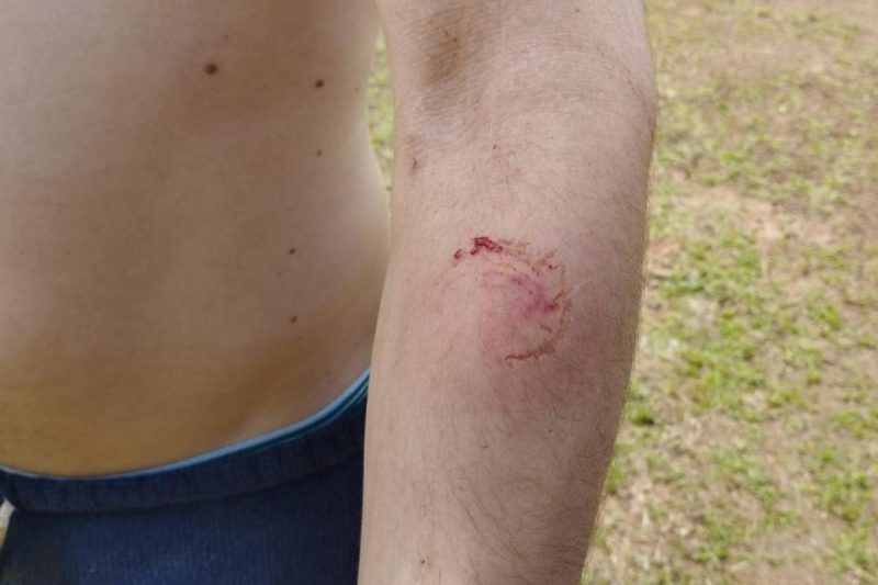 Testemunha foi mordida pelo assaltante – Foto: Pol&iacute;cia Militar/Divulga&ccedil;&atilde;o/ND