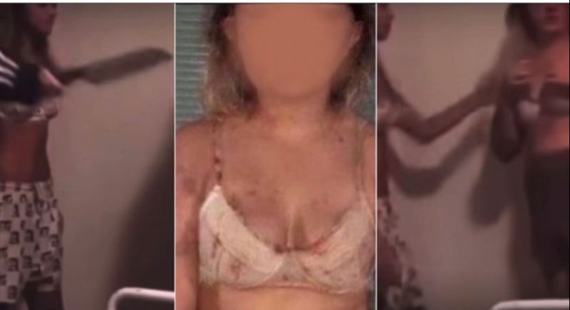 Menina de 13 anos &eacute; torturada na Austr&aacute;lia – Foto: REPRODU&Ccedil;&Atilde;O INSTAGRAM/@JUSTICE_FOR_KIRRAHART