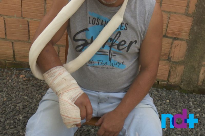 V&iacute;tima teve o bra&ccedil;o quebrado – Foto: Robson Oliveira/NDTV