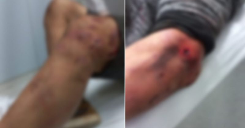 Homem &eacute; agredido por 8 pessoas com golpes de enxada e madeira em Crici&uacute;ma – Foto: PMSC/Divulga&ccedil;&atilde;o/ND