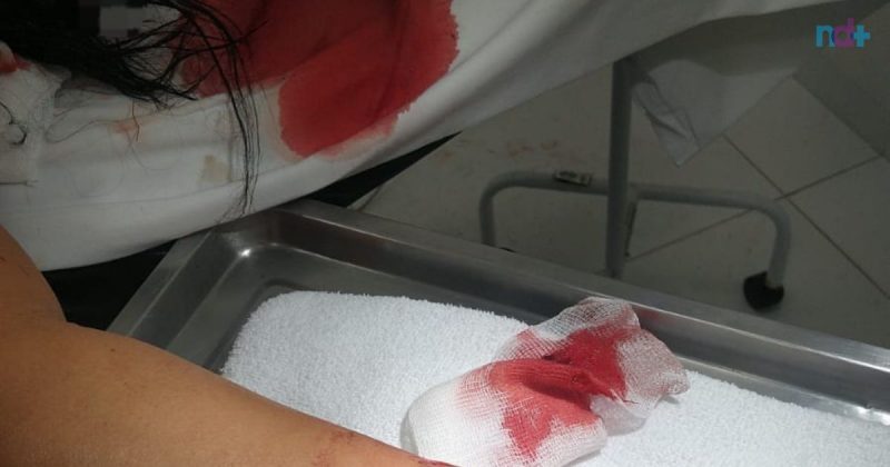 mulher foi esfaqueada pelo marido durante churrasco em Bombinhas