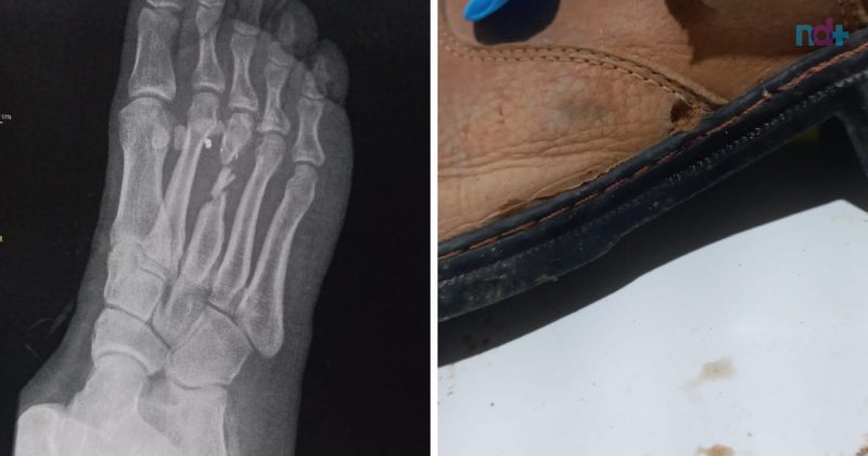 Tiro no pé foi disparado por vizinho de terreno em Tijucas