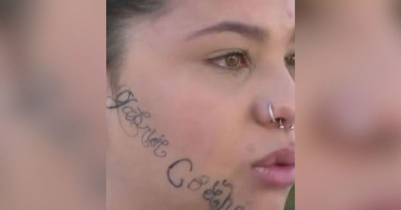 Jovem como ficou rosto ap&oacute;s v&aacute;rias sess&otilde;es de remo&ccedil;&atilde;o das tatuagens feitas pelo ex-namorado, em maio de 2022 – Foto: R7/Divulga&ccedil;&atilde;o/ND