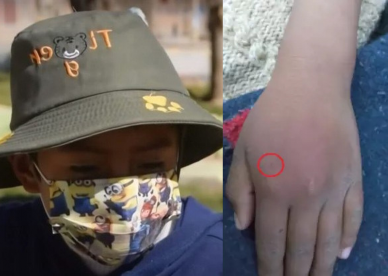 Viúva-negra pica mão de menino para virar homem aranha