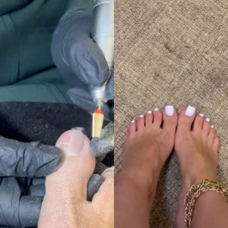 Maria Lina compartilhou resultado de harmonização no pé 