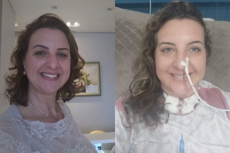 &Agrave; esquerda, Suzana antes de contrair dengue. &Agrave; direita, ela no hospital para a cirurgia que realizou nesta 1&ordf; semana de agosto – Foto: Arquivo Pessoal/ND