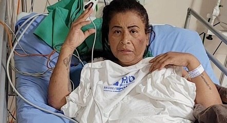 Funkeira precisou amputar perna ap&oacute;s trombose – Foto: Reprodu&ccedil;&atilde;o/Internet/ND