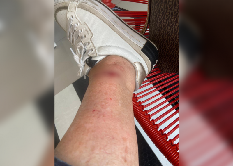 Noemia foi atropelada no dia 25 de agosto, no Centro de Florian&oacute;polis – Foto: Arquivo Pessoal/ND