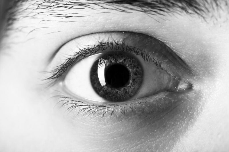 A black and white photograph showing the eye close up to illustrate a report of blindness caused by a fungus.