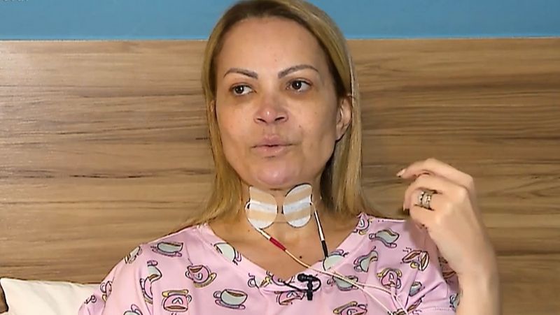 Solange Almeida teve lesões nas cordas vocais