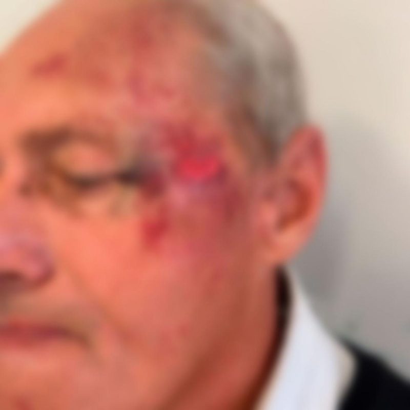 Taxista ficou ferido no rosto 