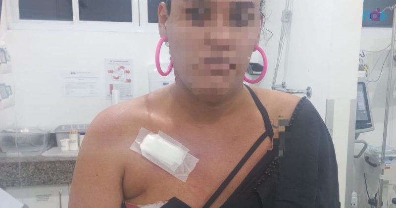 Transexual contou que seguia para o trabalho quando foi assaltada e esfaqueada por um homem; imagem mostra ferimento da vítima e roupa rasgada