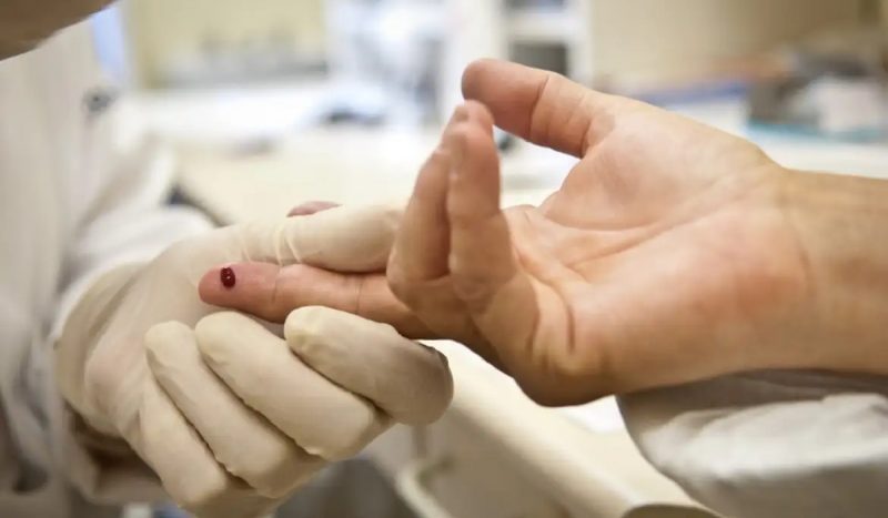 Teste para HIV é feito em FLorianópolis