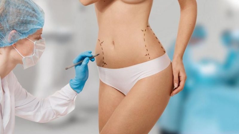 Médica faz traçado para cirurgia plástica