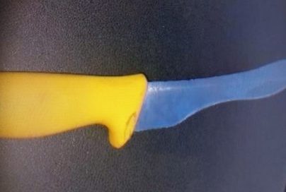 Mulher foi internada no hospital com diversos ferimentos – Foto: Reprodu&ccedil;&atilde;o/PM