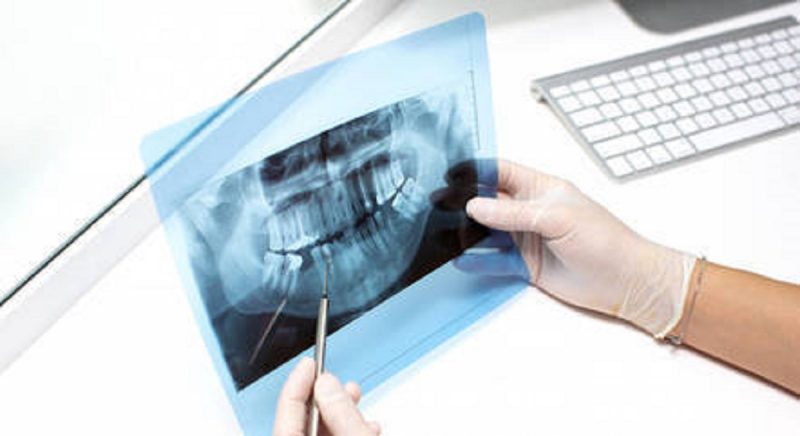 Dentes são a única parte do corpo humano que não desenvolvem câncer