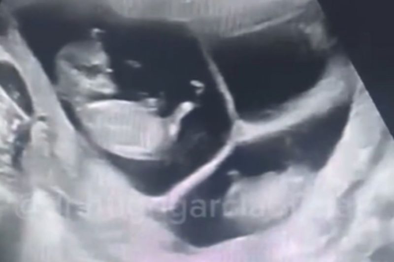 Pai não aguentou a emoção