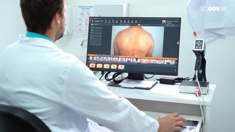 Protetor solar é medida para prevenção contra o câncer de pele 