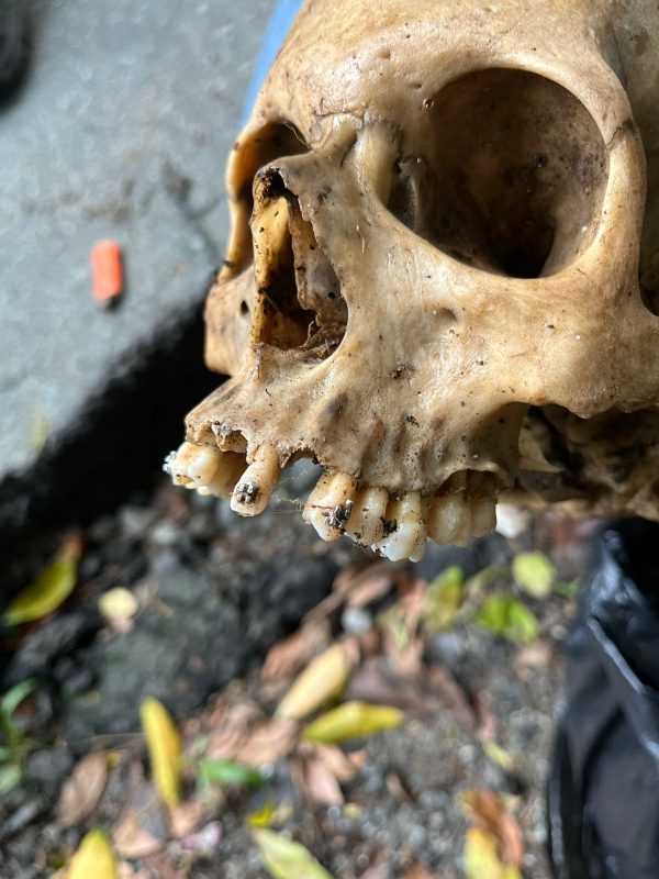 Imagem mostra crânio de ossada humana encontrada em avenida de Balneário Camboriú