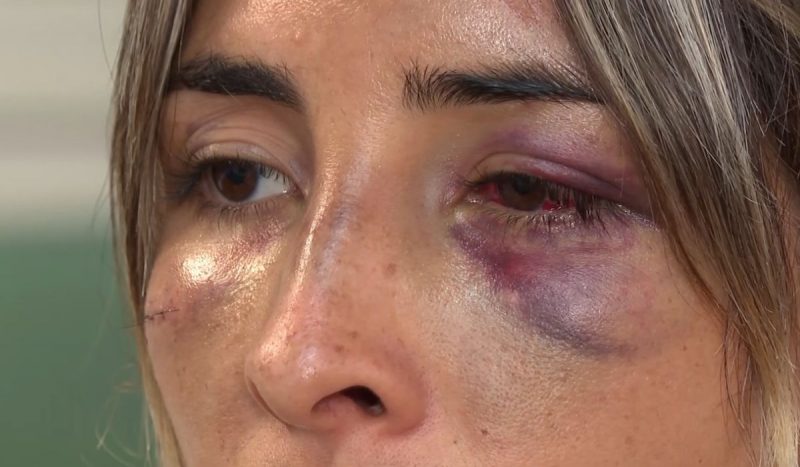 Vítima foi espancada por mulher em situação de rua