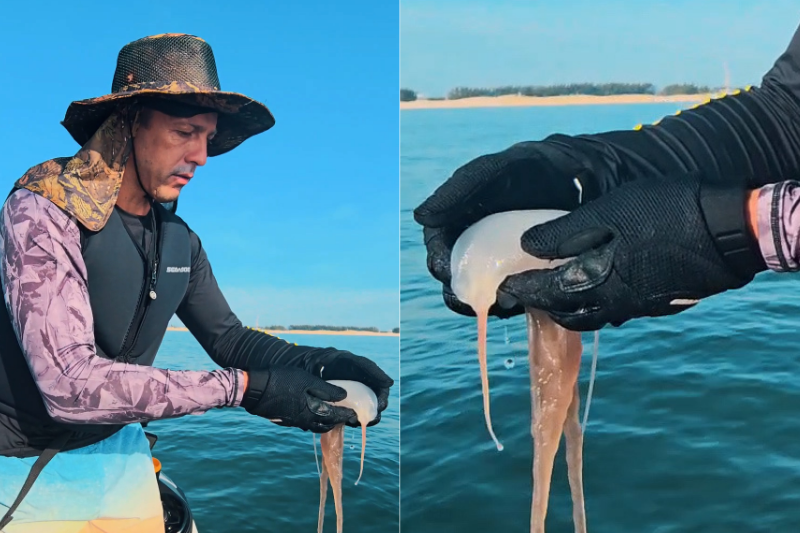 Vinagre e água do mar são aconselhados para queimaduras por águas