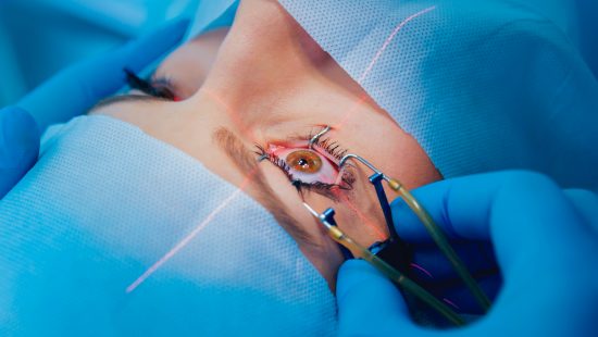 Cirurgia refrativa a laser para correção de grau: quem pode fazer, benefícios e riscos