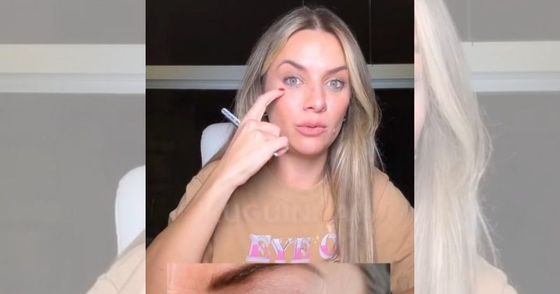 Dermatologista fala de procedimentos estéticos que nunca faria 