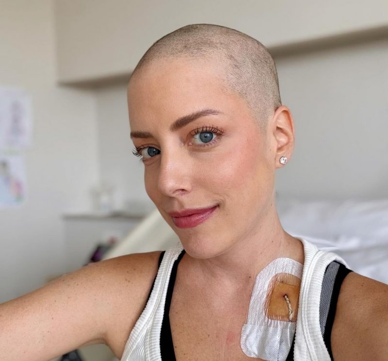 Foto mostra Fabiana Justus careca devido a leucemia mieloide aguda