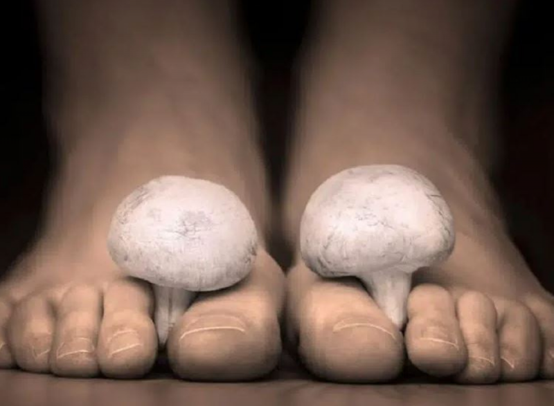 Dermatologista dá dicas de como acabar com o chulé de uma vez por todas