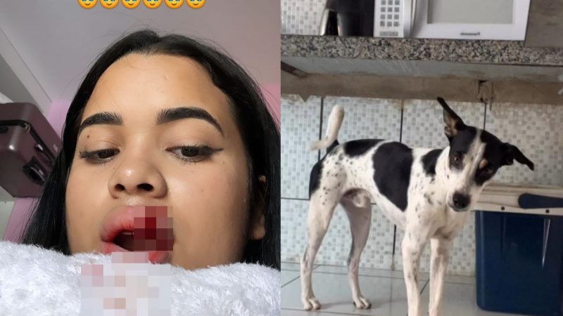 Influencer tem parte do l&aacute;bio arrancado ap&oacute;s tentar beijar cachorro – Foto: Not&iacute;cias ao Minuto/Reprodu&ccedil;&atilde;o/ND
