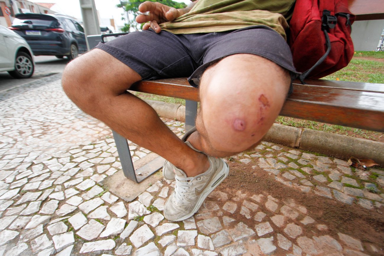 Pessoa em situação de rua Foto mostra pernas de pessoa em situação de rua sentada em um banco