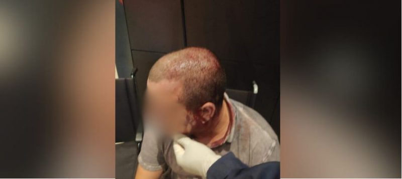 Motorista ficou ferido ap&oacute;s a briga – Foto: Reprodu&ccedil;&atilde;o/PMSC/ND