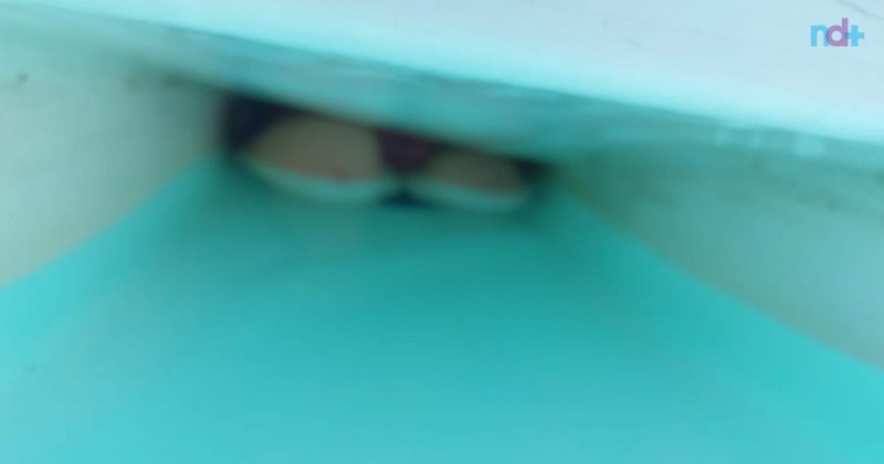 Imagem mostra membros de criança presos em piscina