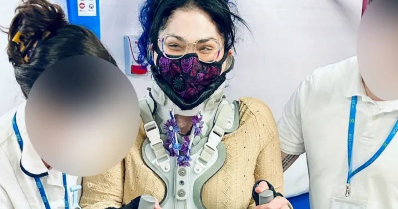 Síndrome do homem elástico faz jovem ter pescoço deslocado do corpo